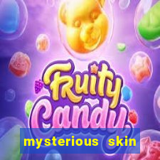 mysterious skin online dublado