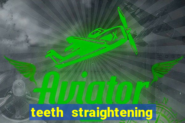 teeth straightening los altos